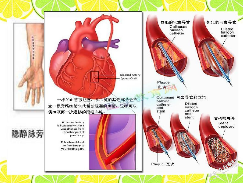 神经内科病人护理安全隐患及防患对策