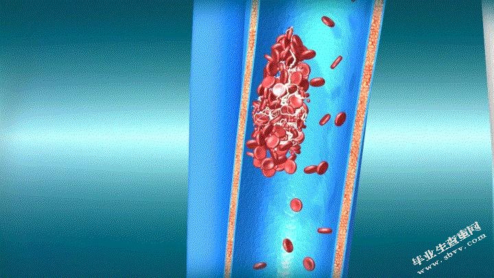 提高一蒂多叶动脉化静脉顺行皮瓣成活稳定性的临床研究
