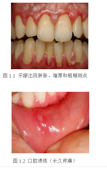 口腔癌发病的相关因素及其分子生物学机制研究进展