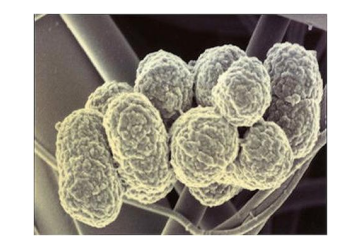 口腔癌发病的相关因素及其分子生物学机制研究进展
