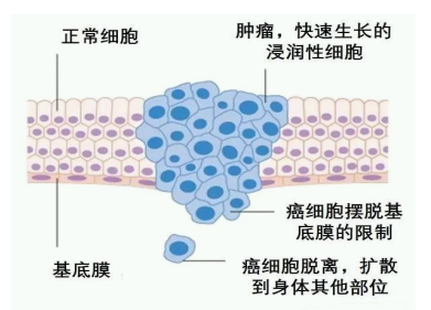 口腔癌发病的相关因素及其分子生物学机制研究进展