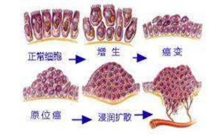 口腔癌发病的相关因素及其分子生物学机制研究进展