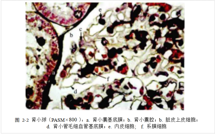基于多示例学习的糖尿病肾病中基底膜增厚的识别