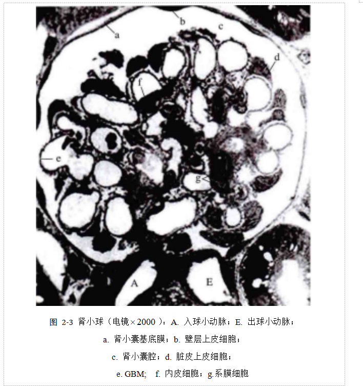 基于多示例学习的糖尿病肾病中基底膜增厚的识别