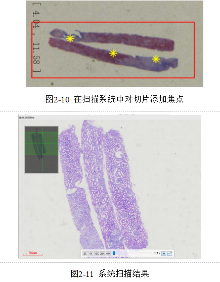 基于多示例学习的糖尿病肾病中基底膜增厚的识别