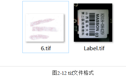 基于多示例学习的糖尿病肾病中基底膜增厚的识别